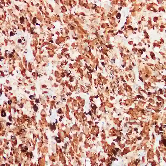 immunohistochemistry (ihc) - s100
